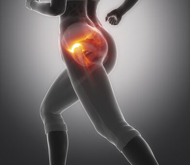 Gluteus tendinopathie